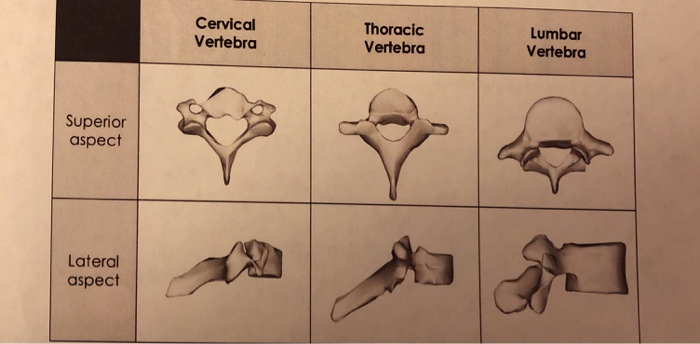 Cervical Vertebro Thoracic Vertebra Lumbar Vertebra Superior aspect Lateral aspect